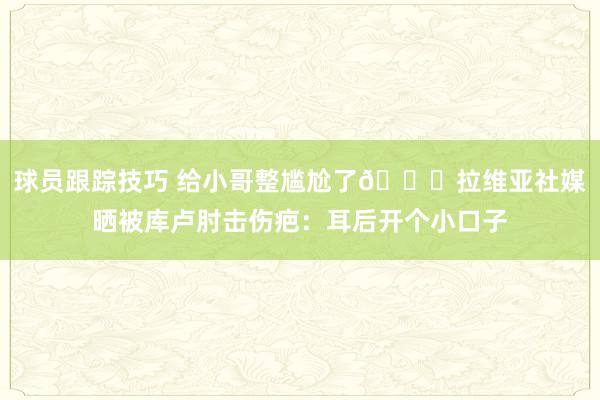 球员跟踪技巧 给小哥整尴尬了😅拉维亚社媒晒被库卢肘击伤疤：耳后开个小口子